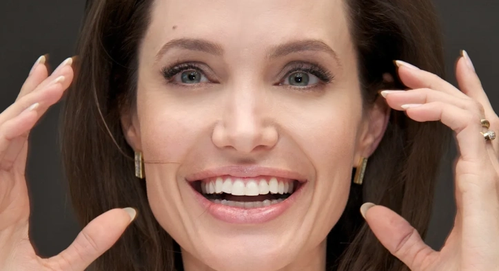 Angelina Jolie Teeth: Veneers and Smile Makeover