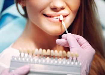 How Much Do Veneers Cost In Turkey In US Dollars?