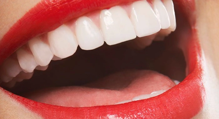 How Much Does Hollywood Smile Treatment Cost?