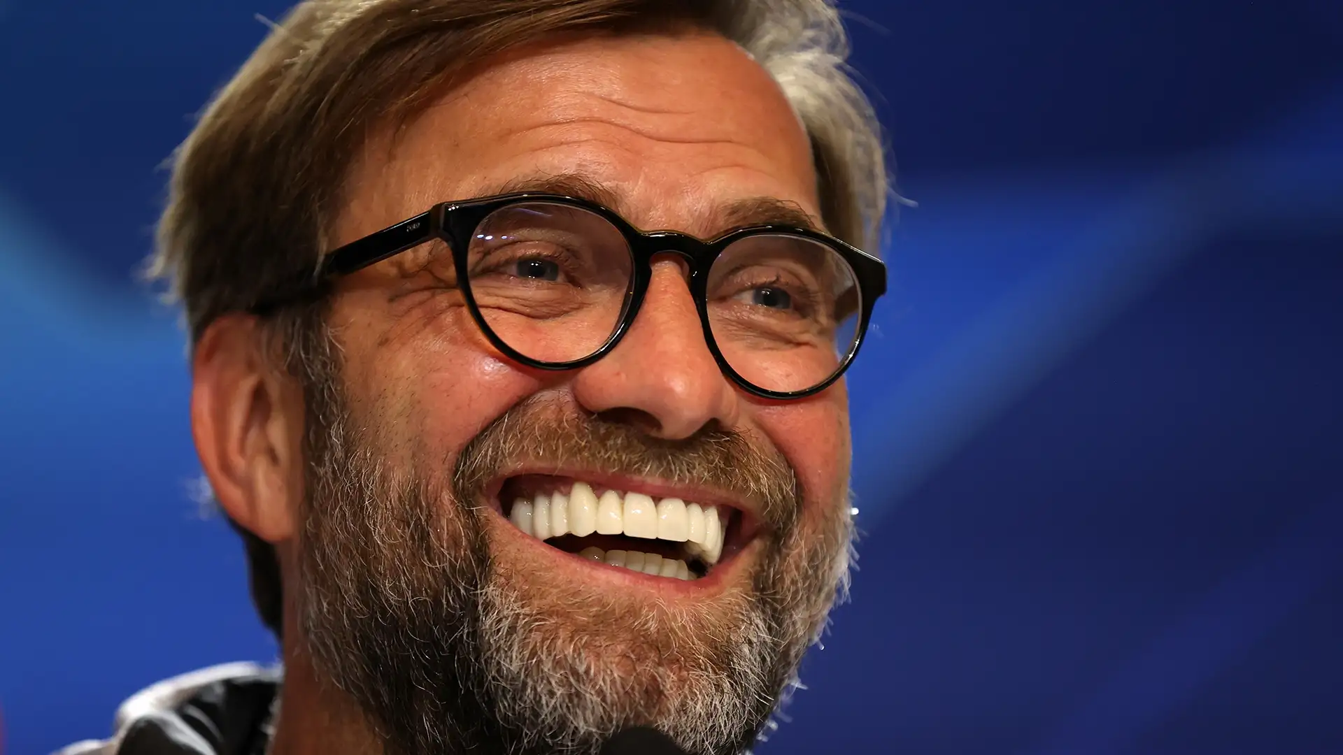 Close-up of Jurgen Klopp’s teeth post-treatment, showing smooth alignment and whitening, reflecting the results of high-quality dental work.