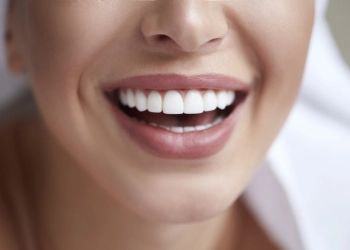 Which Country Is Best For Veneers?