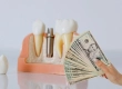 Why Are Dental Implants So Cheap In Turkey?