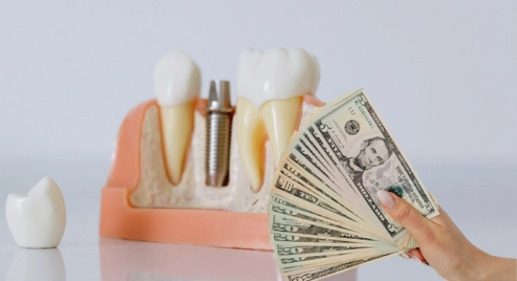 Why Are Dental Implants So Cheap In Turkey?